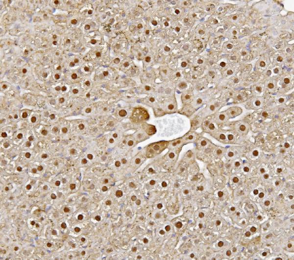  IHC analysis of Alanine Transaminase/Gpt using anti-Alanine Transaminase/Gpt antibody (A01638-1)
