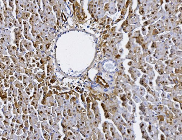  IHC analysis of Alanine Transaminase/Gpt using anti-Alanine Transaminase/Gpt antibody (A01638-1)