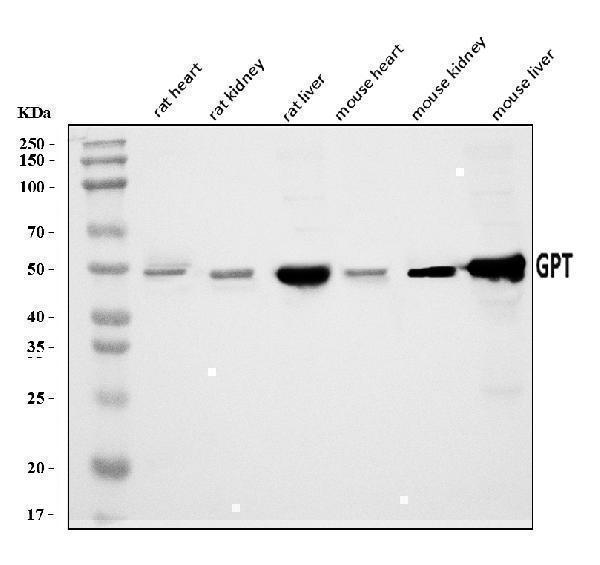  Western blot analysis of Alanine Transaminase/Gpt using anti-Alanine Transaminase/Gpt antibody (A01638-1)
