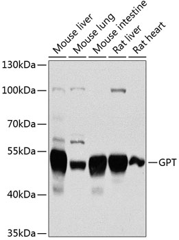 Western blot analysis of extracts of various cell lines, using GPT antibody  at 1:1000 dilution