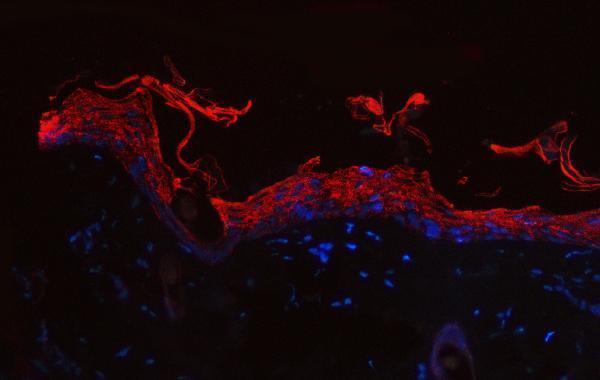  IF analysis of Cytokeratin 1/Krt1 using anti-Cytokeratin 1/Krt1 antibody (A01639-1)