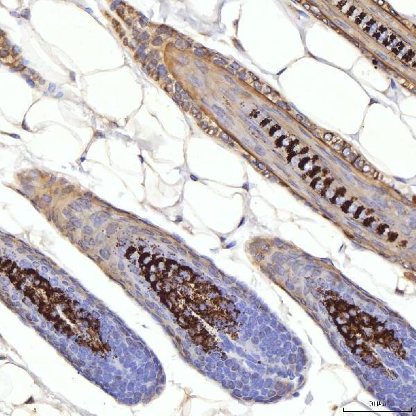  IHC analysis of Cytokeratin 1/Krt1 using anti-Cytokeratin 1/Krt1 antibody (A01639-1)