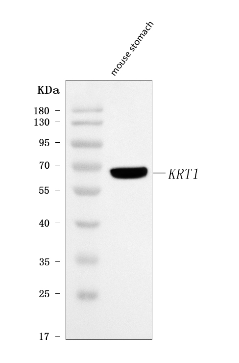  Western blot analysis of Cytokeratin 1/Krt1 using anti-Cytokeratin 1/Krt1 antibody (A01639-1)
