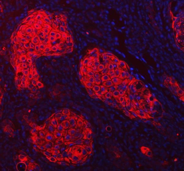  IF analysis of Cytokeratin 1/KRT1 using anti-Cytokeratin 1/KRT1 antibody (A01639)