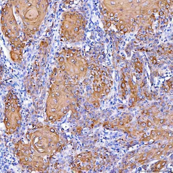  IHC analysis of Cytokeratin 1/KRT1 using anti-Cytokeratin 1/KRT1 antibody (A01639)