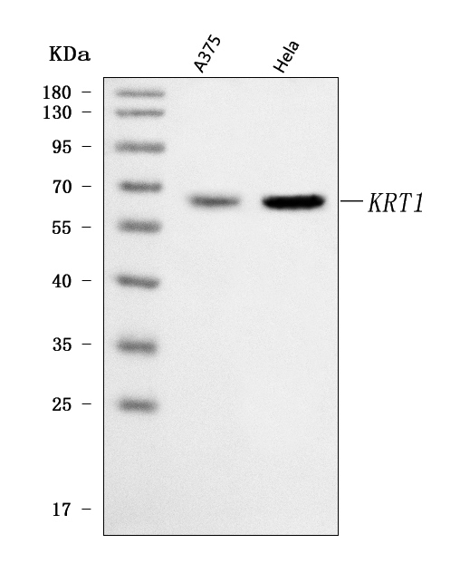  Western blot analysis of Cytokeratin 1/KRT1 using anti-Cytokeratin 1/KRT1 antibody (A01639)