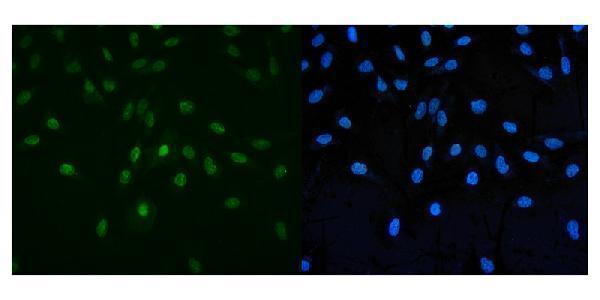  IF analysis of PAF1 using anti-PAF1 antibody (A01640-1)