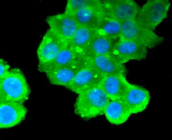 ICC staining MUC16 in HepG2 cells (green)