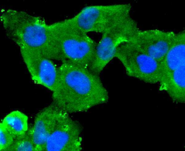 ICC staining MUC16 in Hela cells (green)