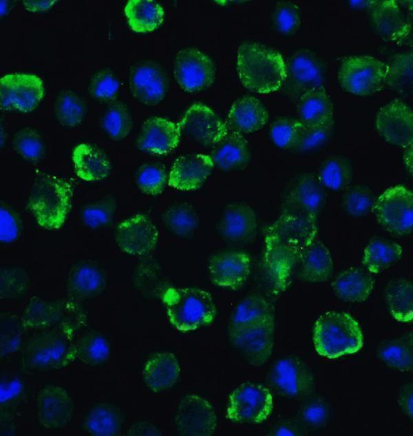 Immunofluorescence of TYK2 in A549 cells with TYK2 Antibody at 20 μg/ml