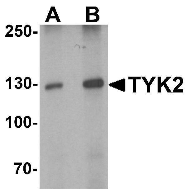 Western blot analysis of TYK2 in human small intestine tissue lysate with TYK2 antibody at (A) 1 and (B) 2 μg/mL