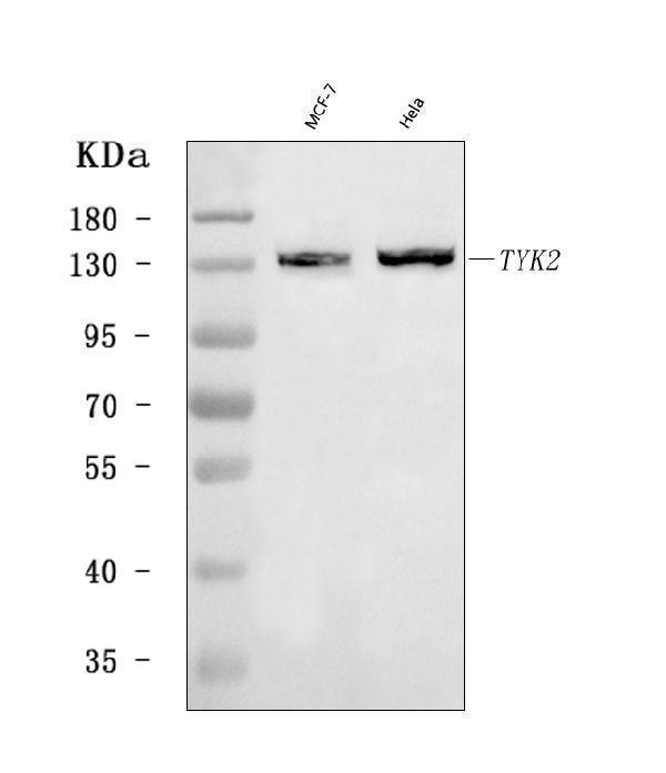  Western blot analysis of TYK2 using anti-TYK2 antibody (A01642-3)