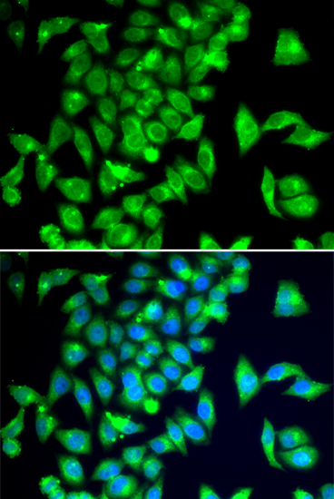 a01643 tph2 primary antiboties if testing 1