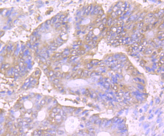 a01644 1 vps35 primary antiboties ihc testing 2