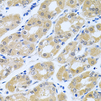 a01647 2 gne primary antiboties ihc testing 3