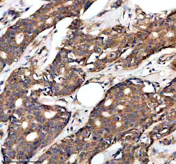 IHC analysis of GNE using anti-GNE antibody (A01647-3)