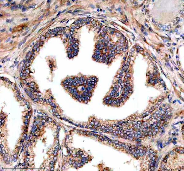 IHC analysis of GNE using anti-GNE antibody (A01647-3)
