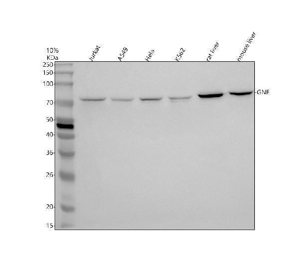 Western blot analysis of GNE using anti-GNE antibody (A01647-3)