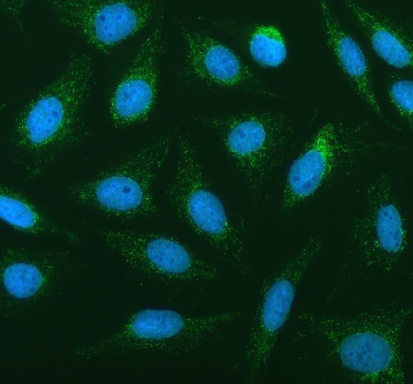 a01648 1 pla2g6 primary antibodies if testing 1