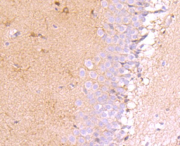 a01652 1 muc4 primary antiboties ihc testing 2
