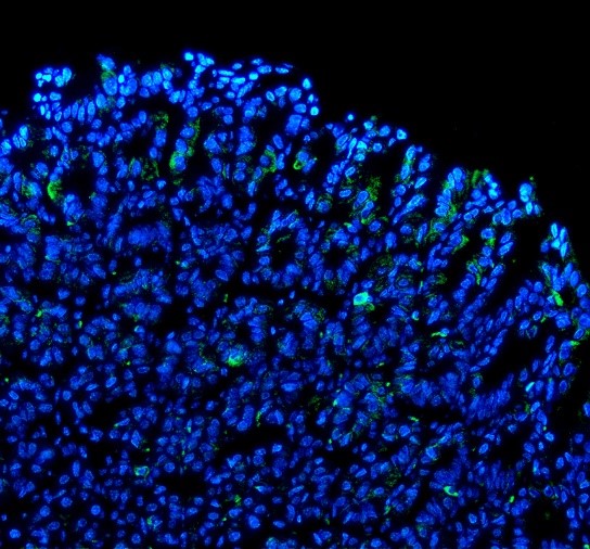IF analysis of MUC4 using anti-MUC4 antibody (A01652-2)