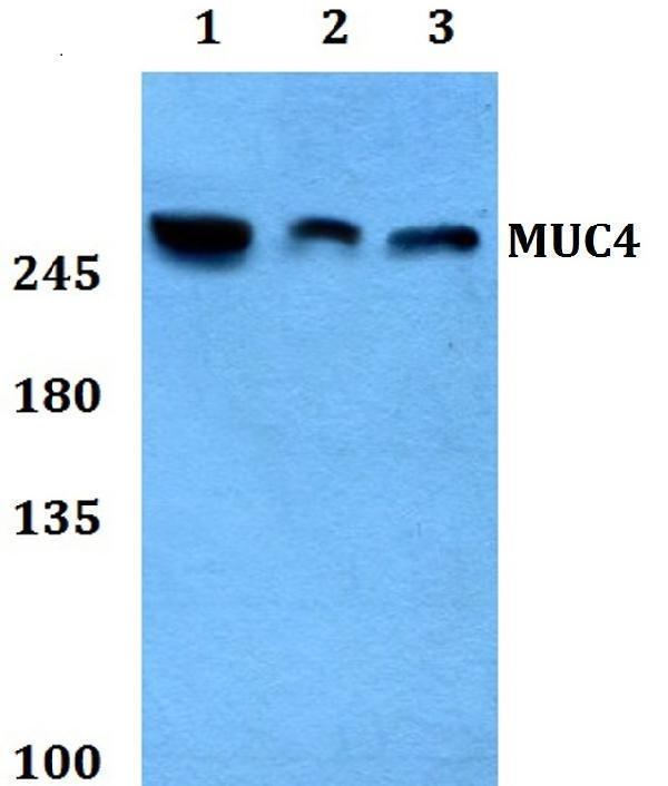 Western blot (WB) analysis of Mucin 4 polyclonal antibody at 1:500 dilution
Lane1:Hela whole cell lysate
Lane2:sp2/0 whole cell lysate
Lane3:PC12 whole cell lysate