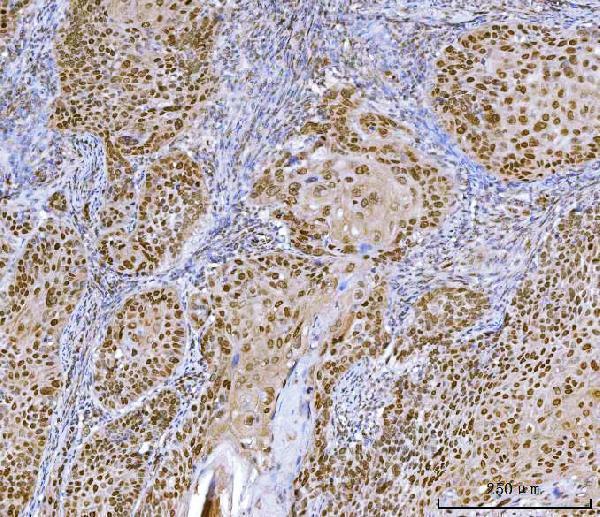 a01653 4 cux1 primary antibodies ihc testing 4