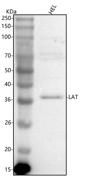  Western blot analysis of LAT using anti-LAT antibody (A01654-1)