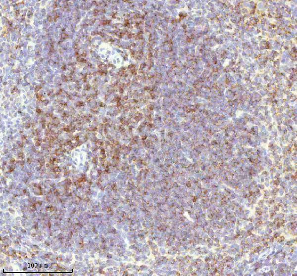 a01654 2 lat primary antibodies ihc testing 4