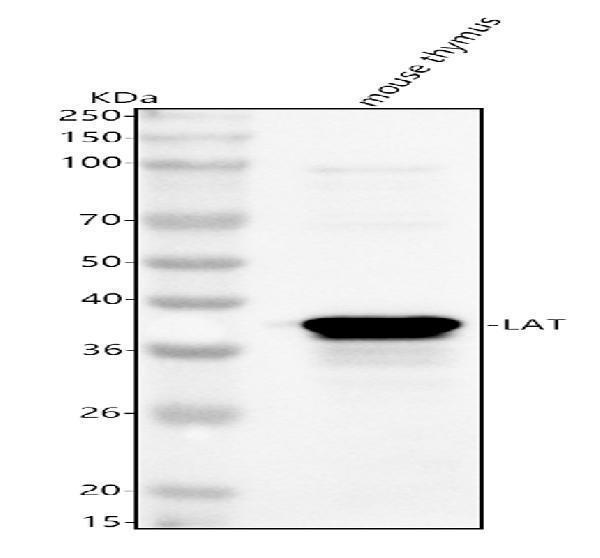 Western blot analysis of Lat using anti-Lat antibody (A01654-2)