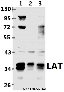 Western blot (WB) analysis of LAT (L185) pAb at 1:500 dilution
Lane1:K562 whole cell lysate(40ug)
Lane2:THP-1 whole cell lysate(40ug)
Lane3:The Spleen tissue lysate of Mouse(40ug)