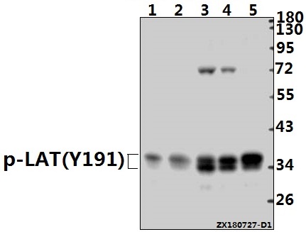 Western blot (WB) analysis of p-LAT (Y191) pAb at 1:1000 dilution
Lane1:H9C2 whole cell lysate(40ug)
Lane2:RAW264