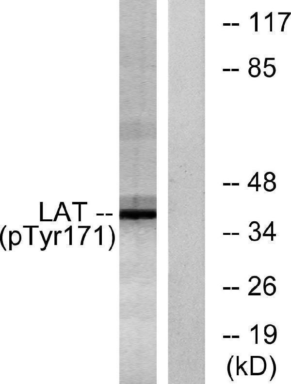 Western blot analysis of lysates from Jurkat cells treated with UV 15', using LAT (Phospho-Tyr171) Antibody