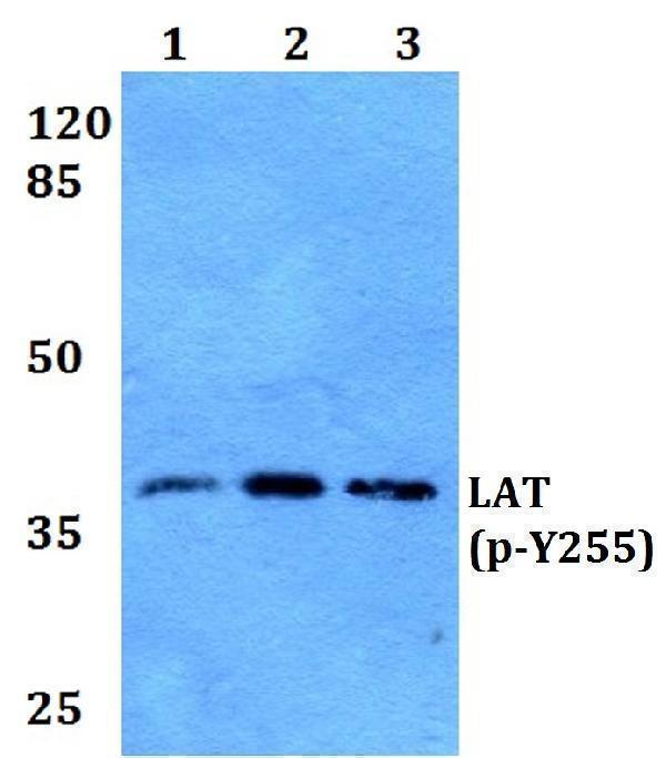 Western blot (WB) analysis of p-LAT (Y255) polyclonal antibody at 1:500 dilution
Lane1:HEK293T whole cell lysate
Lane2:Raw264