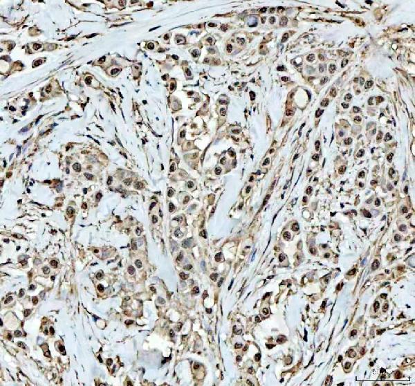a01655 1 dck primary antibodies ihc testing 2_1