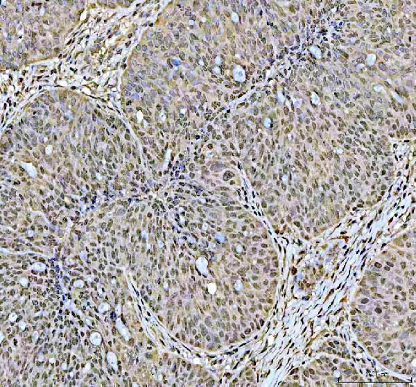 a01655 1 dck primary antibodies ihc testing 3_1