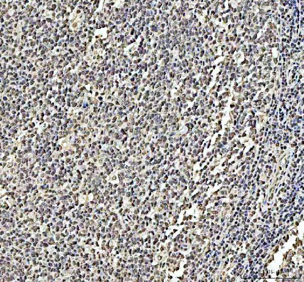 a01655 1 dck primary antibodies ihc testing 4_1