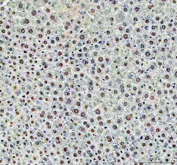 a01655 1 dck primary antibodies ihc testing 5_1