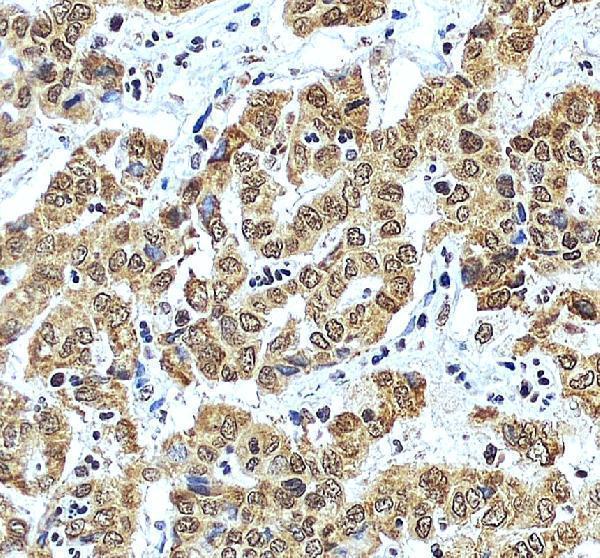 IHC analysis of DDX17 using anti-DDX17 antibody (A01656)