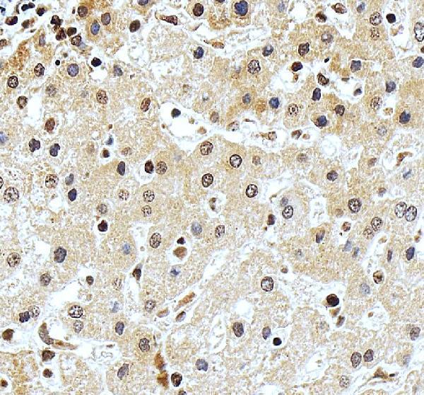 IHC analysis of DDX17 using anti-DDX17 antibody (A01656)