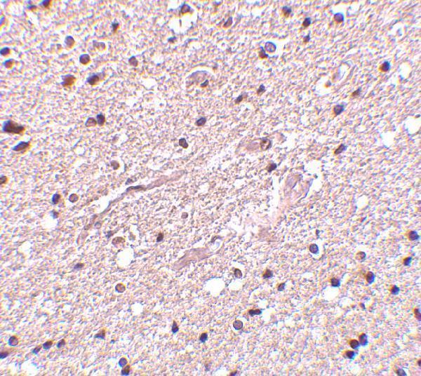 a01658 hap1 primary antibodies ihc testing 2