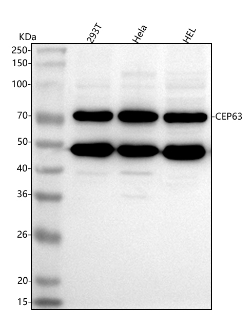  Western blot analysis of CEP63 using anti-CEP63 antibody (A01661-1)