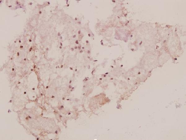 a01663 1 grb10 primary antiboties ihc testing 2