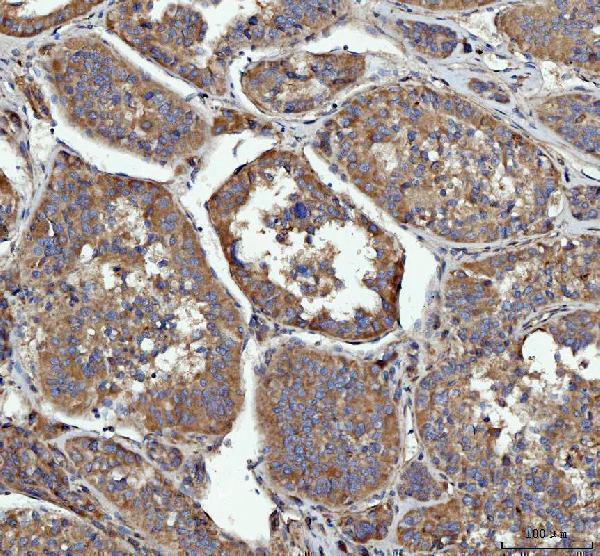 a01663 2 grb10 primary antibodies ihc testing 4_1
