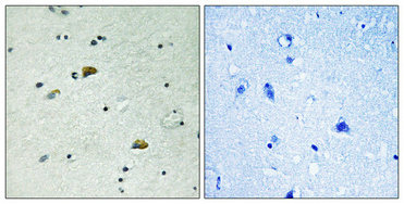 a01663y67 grb10 primary antibodies ihc testing 4