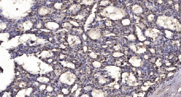 a01665 1 sox17 primary antibodies ihc testing 1