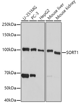 a01666 sort1 primary antiboties wb testing 1
