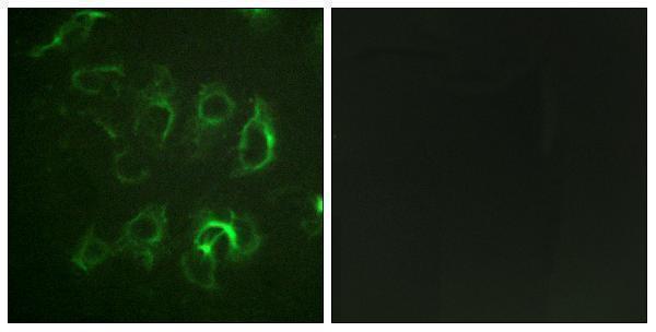 a01670 scnn1b primary antibodies if testing 1