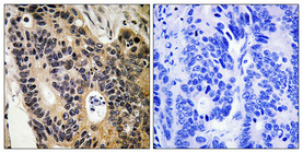 a01670 scnn1b primary antibodies ihc testing 2