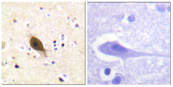 a01670 scnn1b primary antibodies ihc testing 3